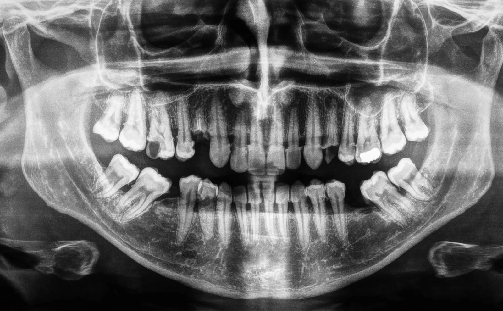 dental-x-ray